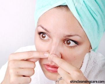 Ways to Get Rid of Blackheads